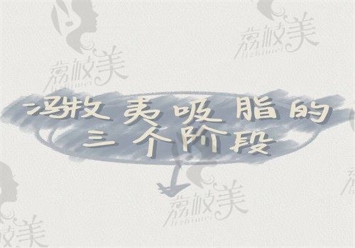 冯牧夷吸脂的三个阶段给你看，发现冯牧夷ELS低创吸脂技术是真好