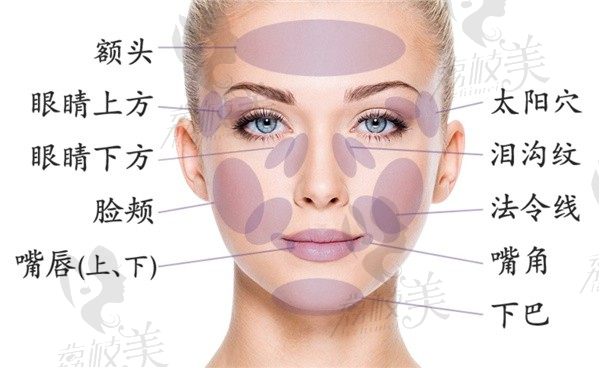 babyface是什么美容項(xiàng)目？主要填充哪個部位？用什么材料好？