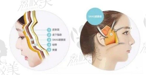 围观：成都蒲兴旺面部五层提升的实例，五层提升术打造无痕自然美