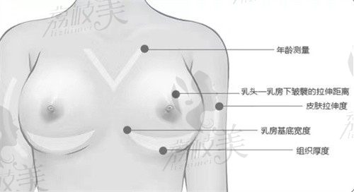 罗盛康隆胸修复怎么样?擅长解决包膜挛缩/假体破裂/胸部感染等情况