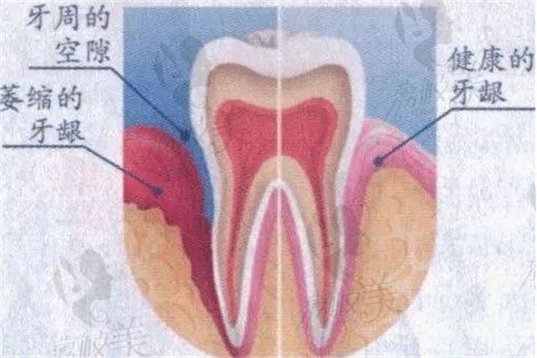 手术前