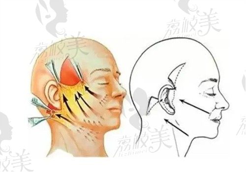 国内做拉皮手术最有名的医生排名，北京/上海/深圳/成都等地在线查询