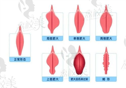 北京嘉禾侯智慧個人簡介資料:擅長陰道緊縮/處女膜修復等私密整形挺厲害