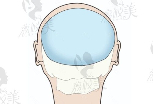 何晉龍peek填后腦勺7W+，價格不貴 還有30+臨床經(jīng)驗加持更安心