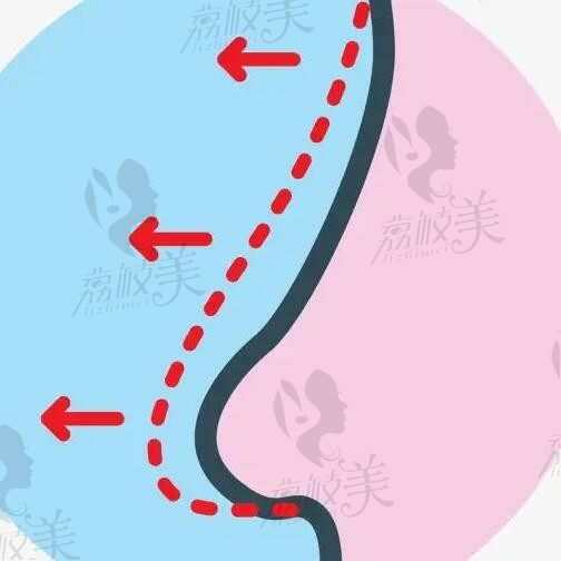 广州颜玲在哪里坐诊？想问下颜玲名气为何那么大是因为做鼻子案例多吗