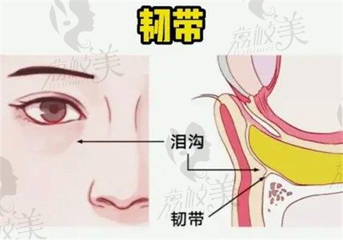 温州和平整形王俊巧泪沟填充价格799起，嗨体熊猫改善泪沟凹陷成效好