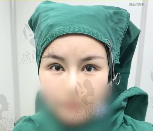 手术后