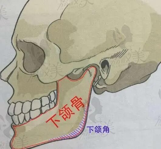 张笑天手术一般要排多久？最少1周建议提前预约挂号张笑天磨骨手术