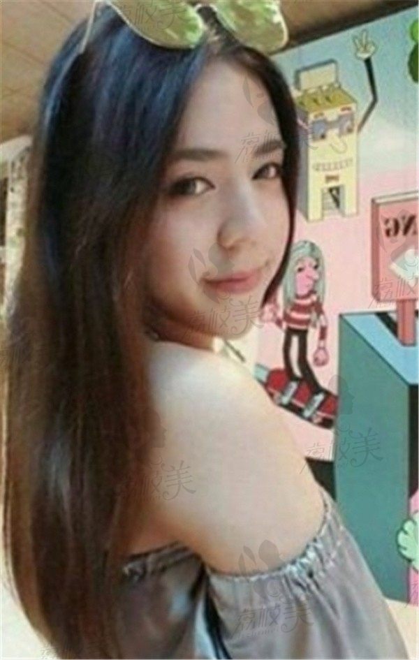 手术后