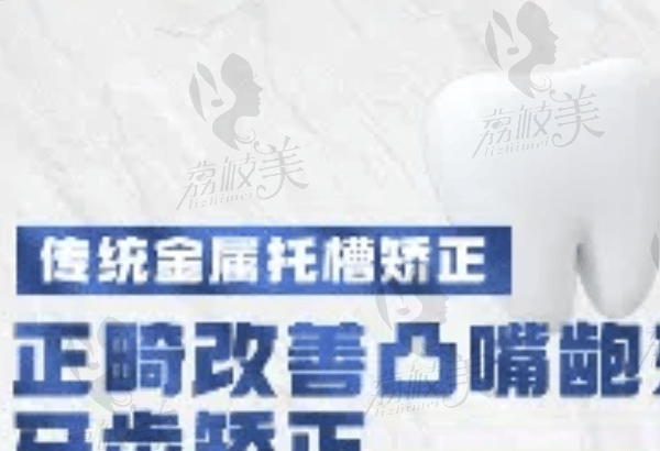 厦门思明好牙依口腔传统金属托槽矫正5993元起，莫蕙妃正畸技术很靠谱