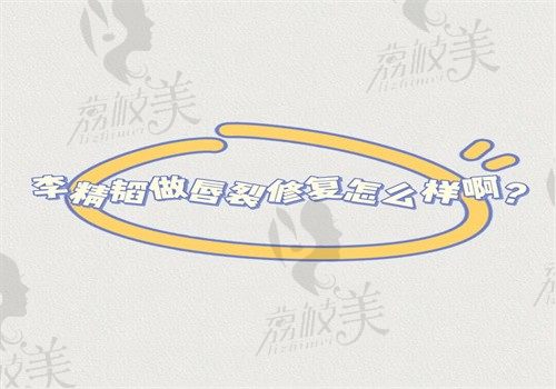 李精韬做唇裂修复怎么样啊？口碑评价好切口隐蔽结果好可预约挂号