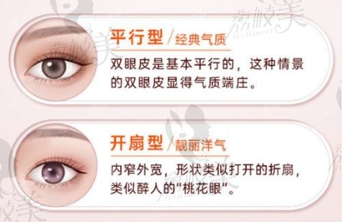 秦皇岛纪辉美容医院做双眼皮怎么样？訾海涛做的双眼皮很自然价格1k-2w
