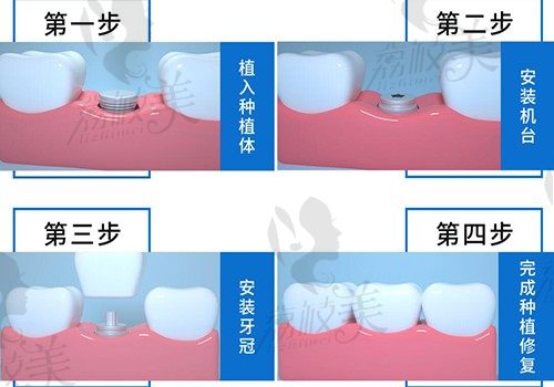 手术前