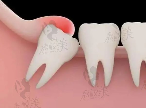 商丘拔牙哪個(gè)醫(yī)院最好？公布商丘市十家口碑好牙科拔牙真靠譜