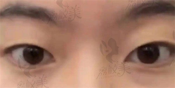 手术前