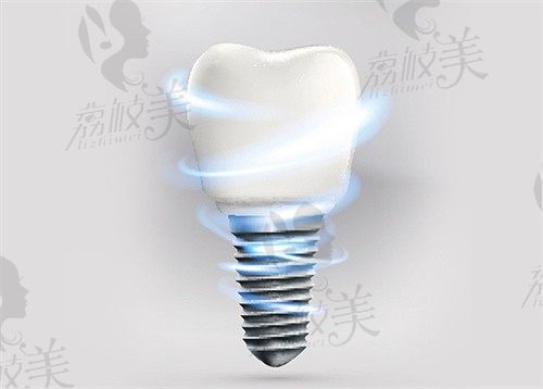 乐莎莎口腔为啥那么便宜?除种植牙集采政策外大型连锁、资源共享也是重要因素