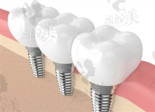 中卫牙科医院排名前十分享,都是中卫看牙技术好收费便宜性价比高的牙科诊所