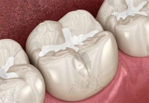 包头牙科比较好的医院排名前十名单:排名前五家不仅看牙技术好收费也实惠