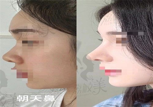 手术前