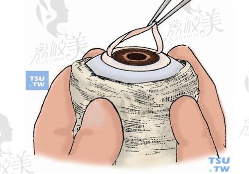 赵少贞和马林在天津医科大学眼科医院坐诊，擅长角膜移植可预约挂号