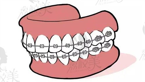 北京張棟梁正畸靠譜嗎?張棟梁北京正畸醫(yī)生排名前三在圈內(nèi)的口碑評(píng)價(jià)特別不錯(cuò)