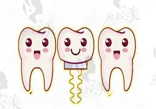 温州瑞安固德熊猫口腔价格表:种植牙2980|矫正牙齿8800|牙冠1800起