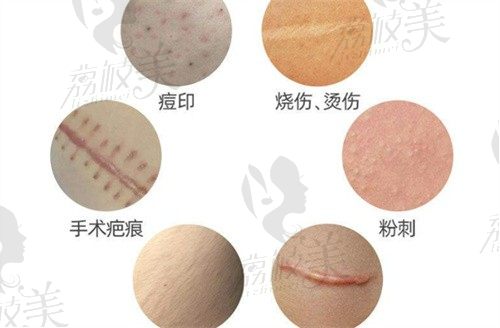 谷培俊醫(yī)生做疤痕手術(shù)好嗎?采用超減張精細(xì)縫合技術(shù)+醫(yī)生親診口碑好特別正規(guī)