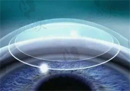 淄博市第一医院眼科怎么挂号？可在线预约挂号很方便