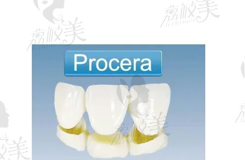 合肥登特尔口腔怎么样？群众口碑非常不错，价格和技术也合人心仪的很