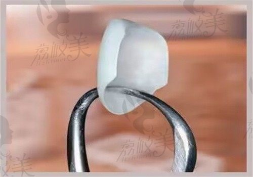 肇庆中大口腔E—max牙齿贴面12颗价格16789元起，黄牙改善作用好