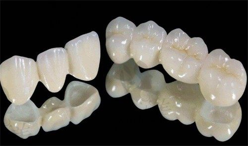 北京美冠塔口腔白翠翠做愛爾創(chuàng)全瓷牙冠2789起,國產(chǎn)品牌性價比更高
