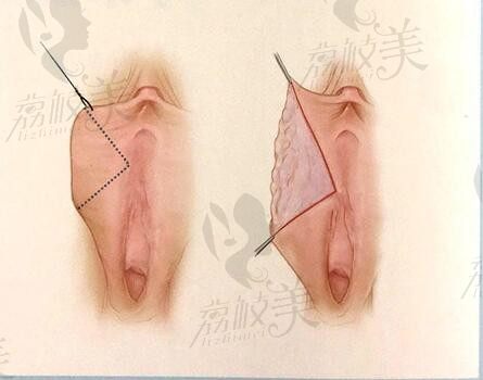 南京哪个医院做私密整形好？2025排名前十强中有公办有私立医院均正规