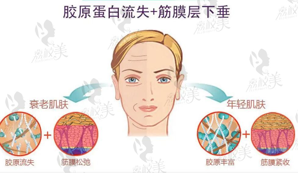 普丽妍童颜针有证吗？是多少钱一支的呀成分是啥注射可以维持多久呢