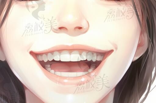 正畸nance弓与tpa区别大吗？打听下两者的价格/作用/优缺点大吗