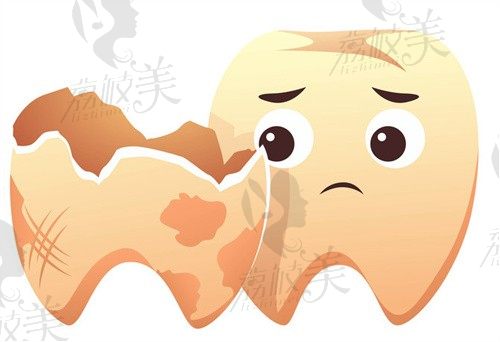 沈阳康贝佳口腔慕林林全瓷冠修复766起,减少牙齿磨损使用寿命长稳固性好
