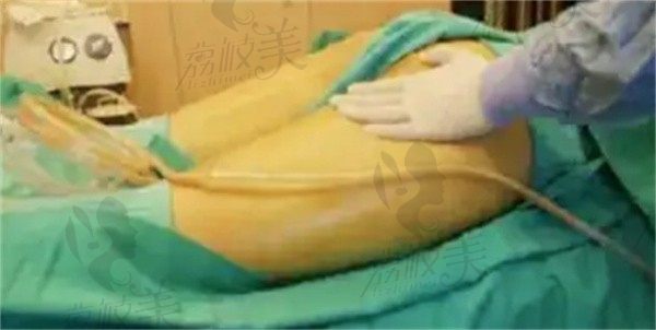 手术前