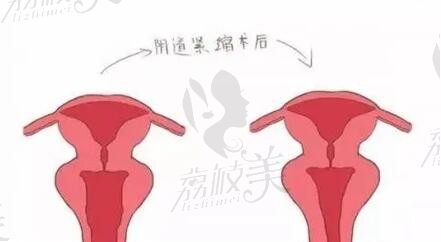 2025南阳天伦医院私密手术多少钱？女性/男性私密手术价格自个查
