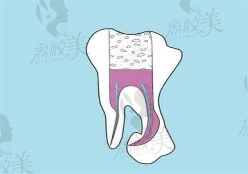 運(yùn)城運(yùn)中口腔李吉祥做成人補(bǔ)牙價(jià)格539元起，穩(wěn)定性高技術(shù)好