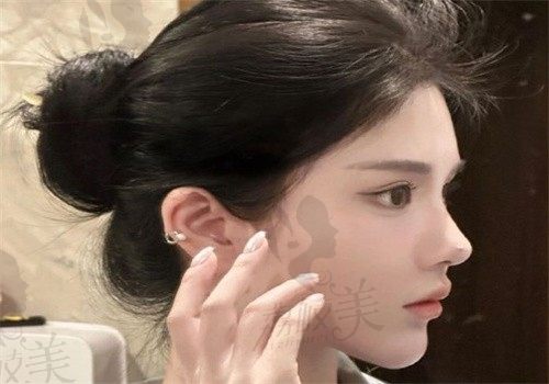成都高新后美醫(yī)療美容醫(yī)院地址在哪里？位于高新區(qū)很正規(guī)薛瑞院長做胸技術(shù)好