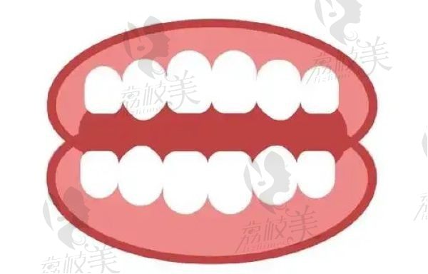邯鄲連保強口腔診所種牙怎么樣？分析技術、設備、醫(yī)生、收費了解