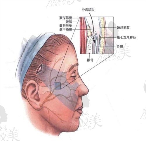 深圳楊建榮拉皮保持多少年?采用高位SMAS筋膜固定提升技術(shù)可維持8~10年很劃算