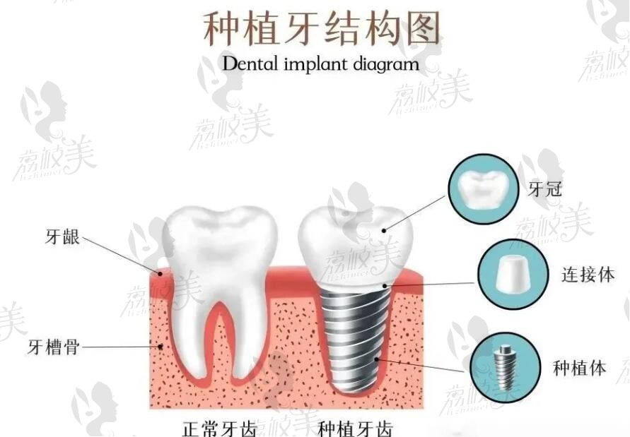 2025海南省人民医院口腔科价目表：含种牙/正畸/牙冠/拔牙/洗牙/牙齿美白...