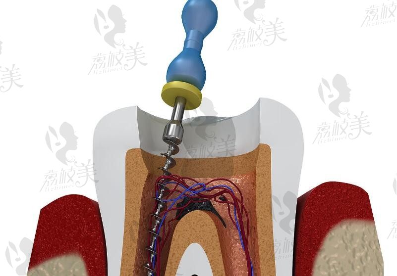 福州白马口腔怎么样？是私立的连锁医院没错但白马是正规医院也不假