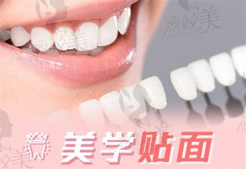 昆明竹子口腔贺光亮做全口E-MAX牙贴面16800起,改善牙黄问题性价比高