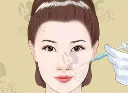上海岳伟医生口碑评价好,是因为岳伟做注射骨雕鼻子价格不贵预约也很方便