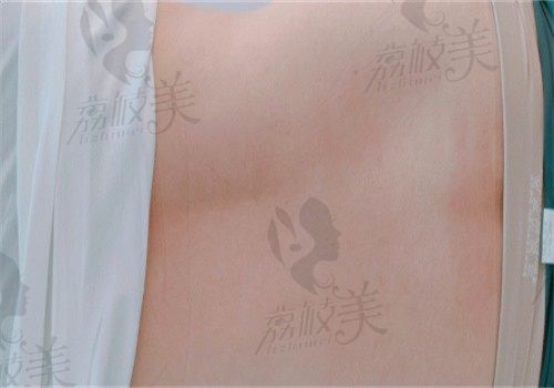 手术前