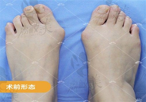 手术前