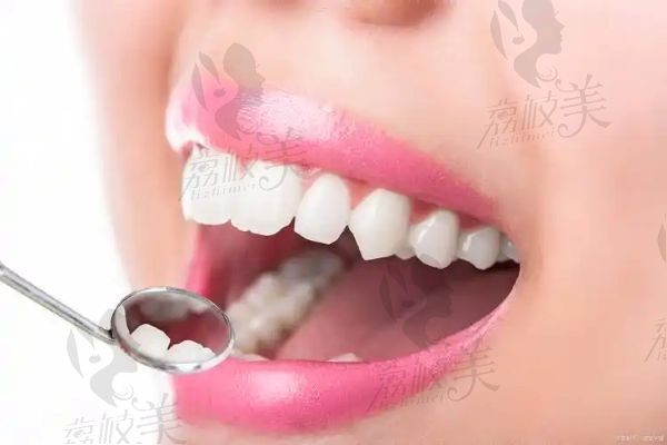 原平牙科诊所哪里好一点？原平口腔医院和小苹果口腔都挺不错的