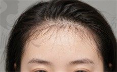手术前
