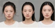 手术后